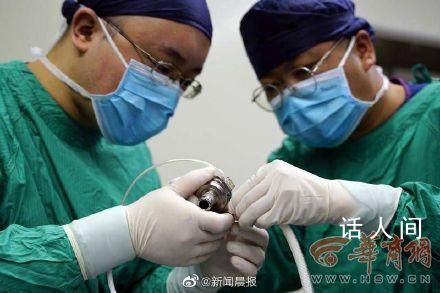 全國首例心臟不停跳人工心臟植入 手術(shù)成功