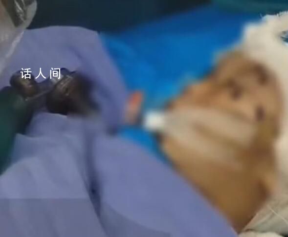 2歲男童因打碎玻璃杯被外婆打成重傷 精神病與女兒的不幸