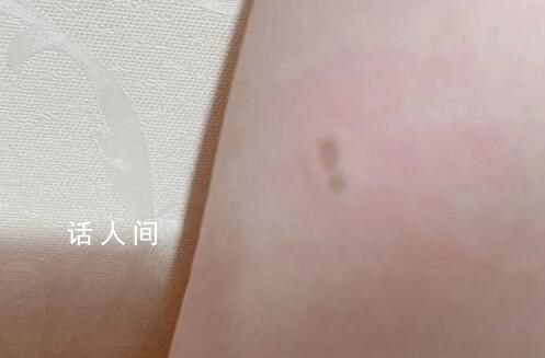 多人稱被蘋果充電頭電傷 引發了網友的關注和討論