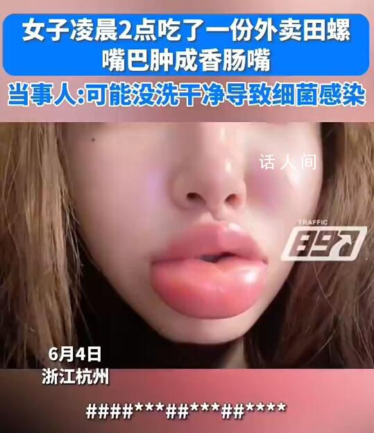 女生半夜嗦田螺腫成香腸嘴 當(dāng)時(shí)以為是辣的
