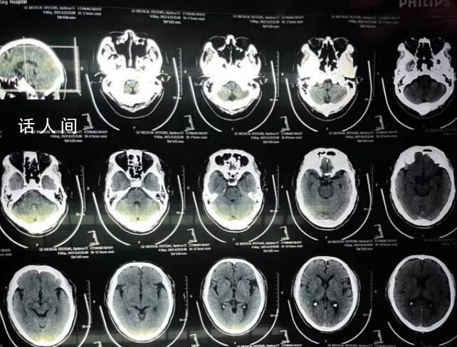 醫生謊稱手術成功致患者身亡 醫生：手術失敗怕打臉