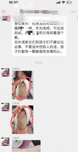 官方通報老師打學生獲家長感謝 引起被打女生家長的不滿和質問