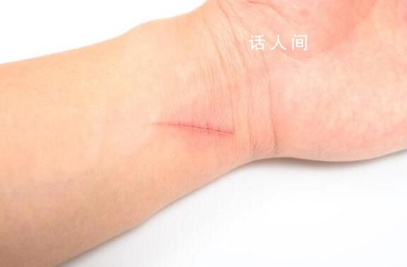 9歲女孩被貓抓傷高燒14天 四肢冰涼且頭痛精神不佳