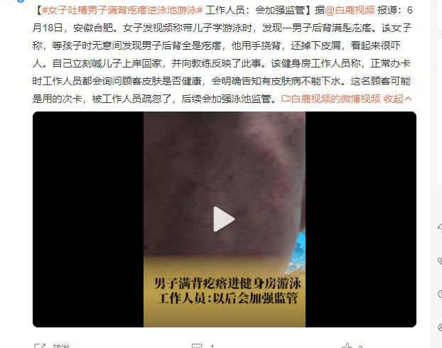 女子吐槽男子滿背疙瘩進泳池游泳 用手撓背還掉下皮屑看起來很嚇人