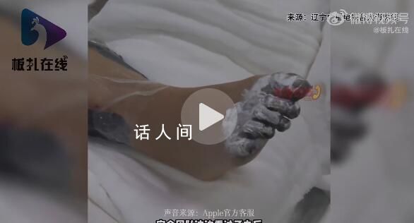 女孩充電被電擊內(nèi)臟受損面臨截肢 這到底是怎么回事