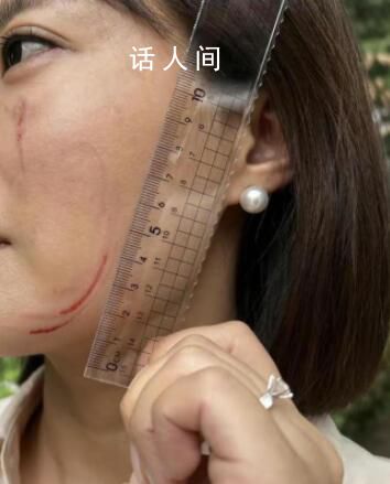 法院回應女子稱被女法官抓傷面部 簡直不可思議呀