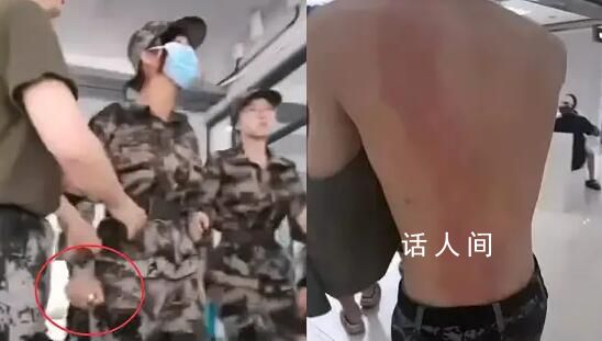 女生用小噴霧器燙傷男生 高校回應