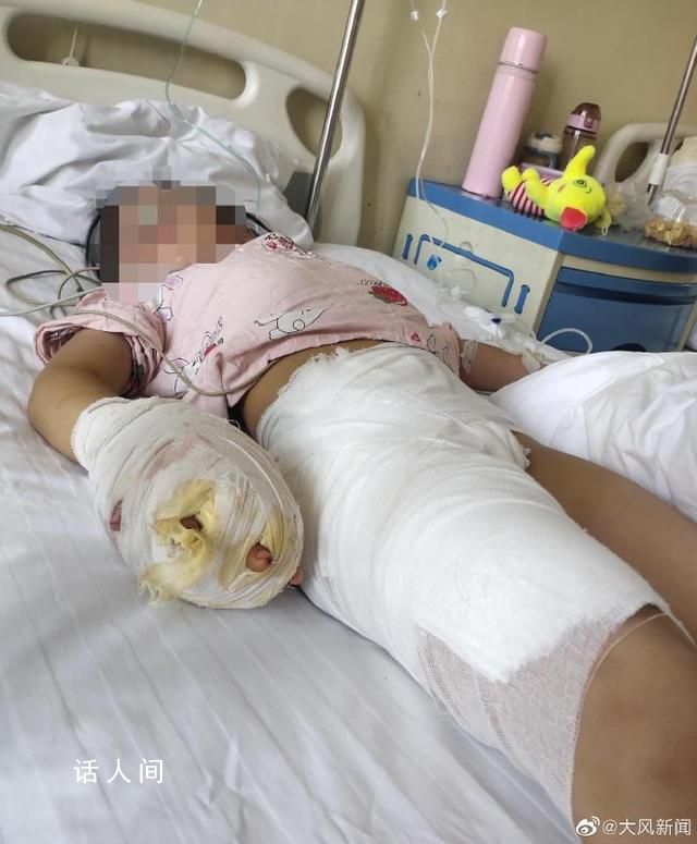 繼母涉嫌虐待繼女致其殘疾 背后真相實在是令人發指