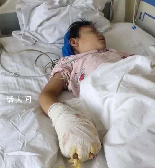 女童被繼母虐待致殘 其父稱絕不和解