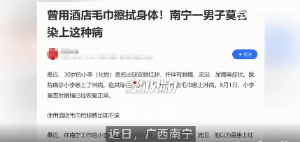 小伙使用酒店毛巾后被確診淋病 到醫院就診用藥治療后眼睛逐漸恢復正常