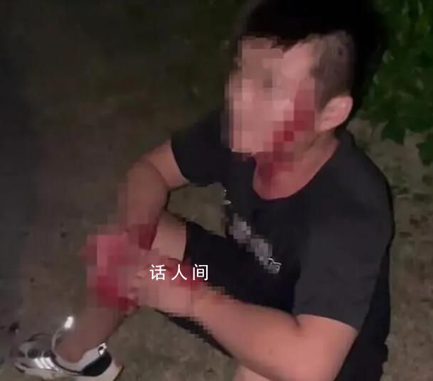 街道辦回應(yīng)多名男子被女子砍傷 涉事女子已被派出所帶走