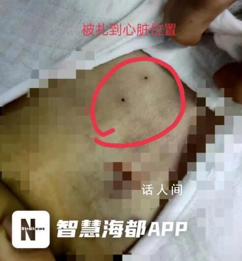 醫院回應穿刺失誤致女童死亡 正在走司法途徑