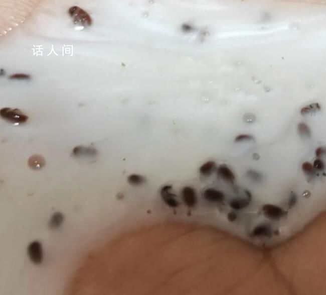 女生稱海飛絲洗發(fā)水?dāng)D出大量蟲卵 實(shí)在是太惡心了