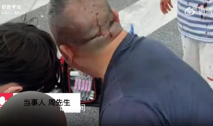 兒子被撞送醫途中車禍致女兒身亡 認為贛州黃金機場對此事有不可推卸的責任