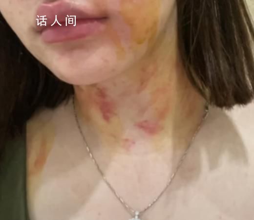 23歲女子自曝遭夫妻兩人毆打扒衣 自貢警方介入調查