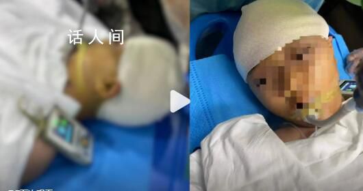 被老師打破頭骨女孩仍在ICU搶救 目前最大的訴求是全力搶救回孩子