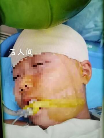女孩被打破頭骨同學大哭:老師殺人了