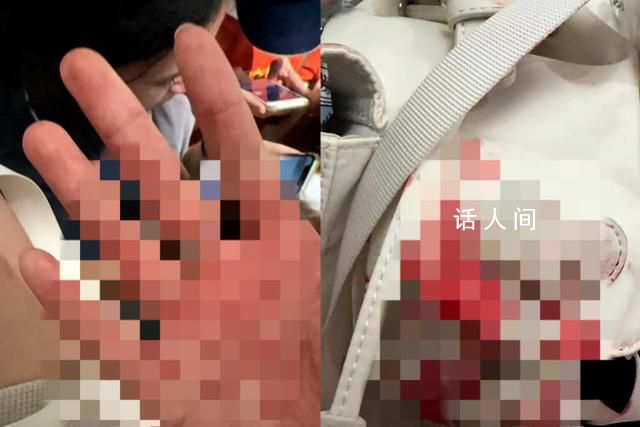 中國游客遇襲身亡:原計劃凌晨回國