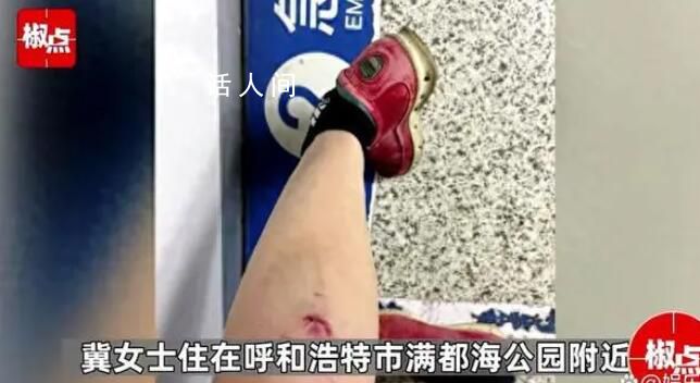 女子帶娃路過公園 被3條流浪狗圍攻