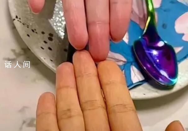 女子為減肥連吃3月胡蘿卜變小橘人 被胡蘿卜染色了