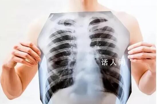 肺癌成為全球新增病例數最多癌癥 2022年全球新增癌癥病例約2000萬例