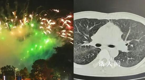 男子沒戴口罩看煙花 被嗆出罕見肺炎