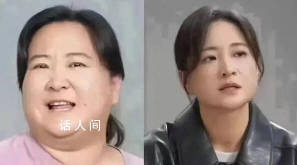 醫生稱賈玲式減肥要有診療團隊 即便做減重手術也很難達到這個效果
