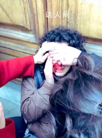 意大利警察毆打挺巴學生 一名女子因警方毆打而眼部受傷