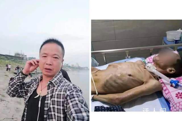 老人扶倒地者卻被車撞成植物人 目前急需救治
