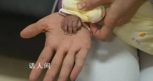 出生時僅650克的巴掌女嬰出院了 終于和媽媽一起回到了家里